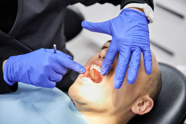 Best Urgent Care for Lost Fillings or Crowns in White Horse, NJ