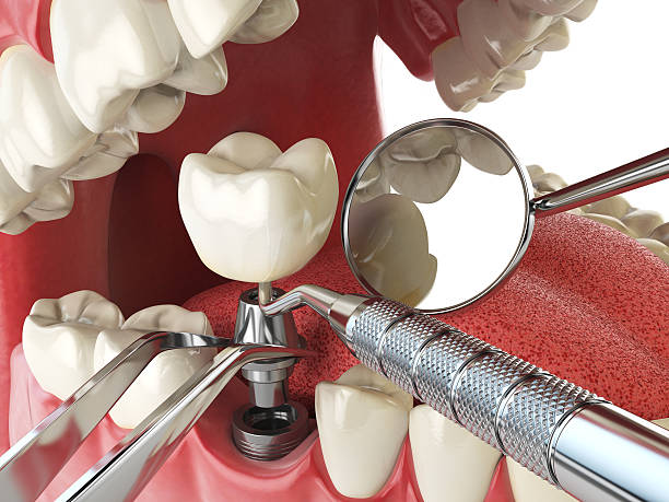 Best Emergency Gum Treatment in White Horse, NJ
