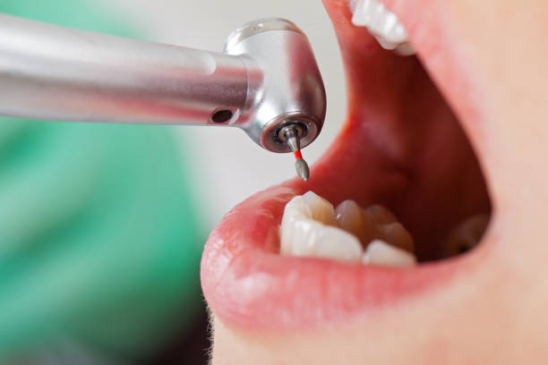 Best Pediatric Emergency Dentist in White Horse, NJ